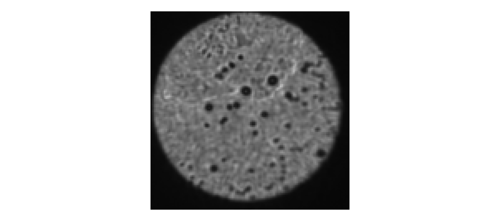 Figure 4.2. Dirty distal facet.