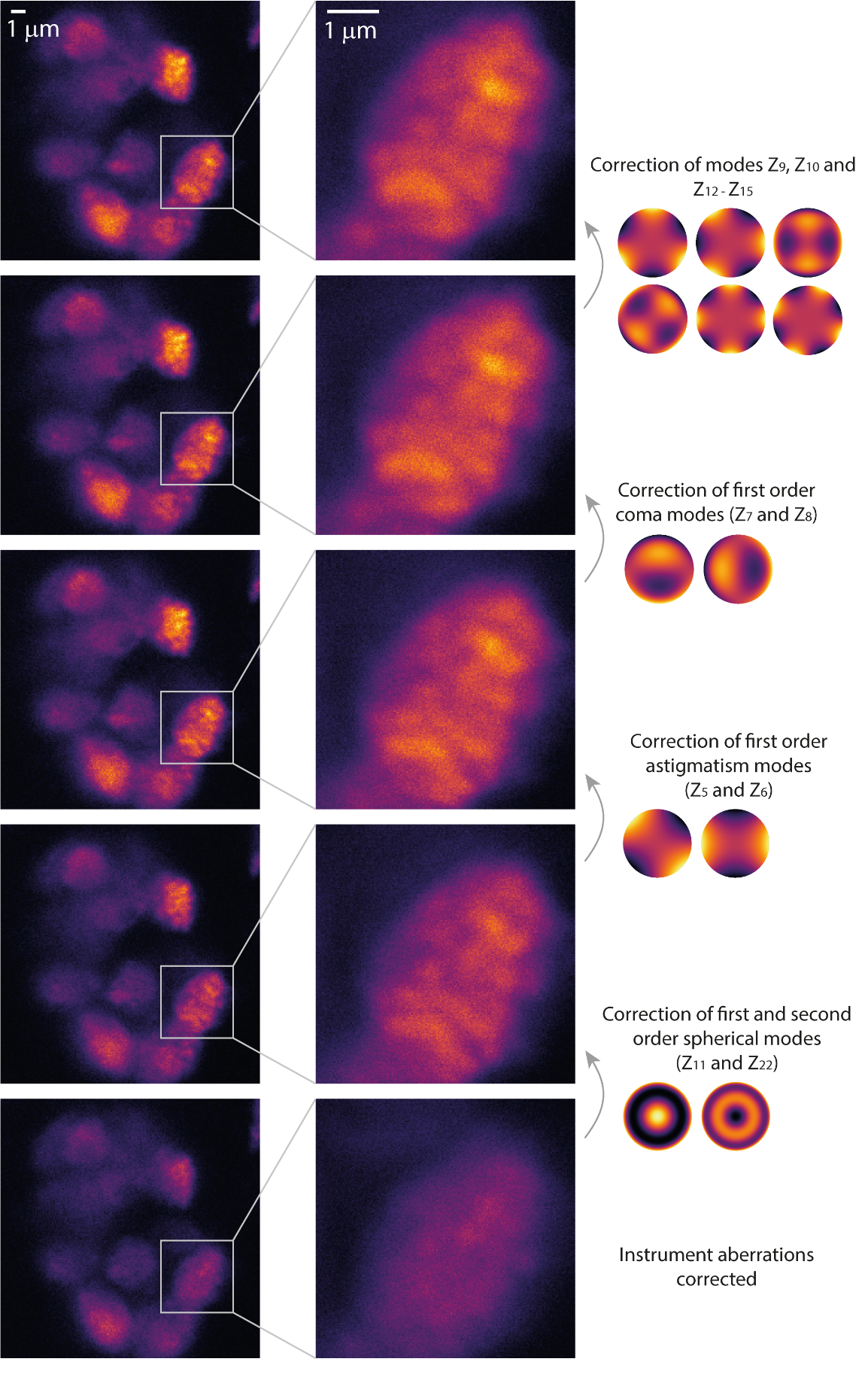 Figure 13. Example of image improvement with different Zernike corrections in a confocal microscope.