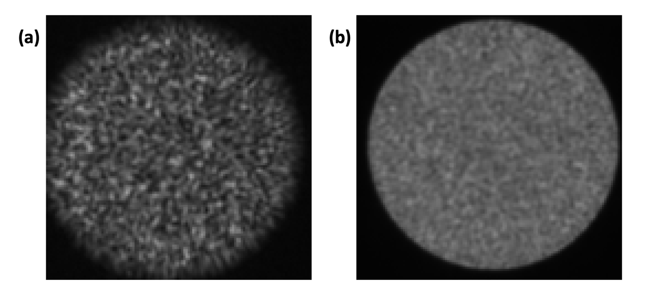 Figure 4.1. Distal facet (a) not well and (b) well aligned with the calibration module.